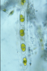 Cymbella prostrata Perlac FS