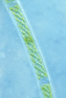 Spirogyra sp. Perlac FS